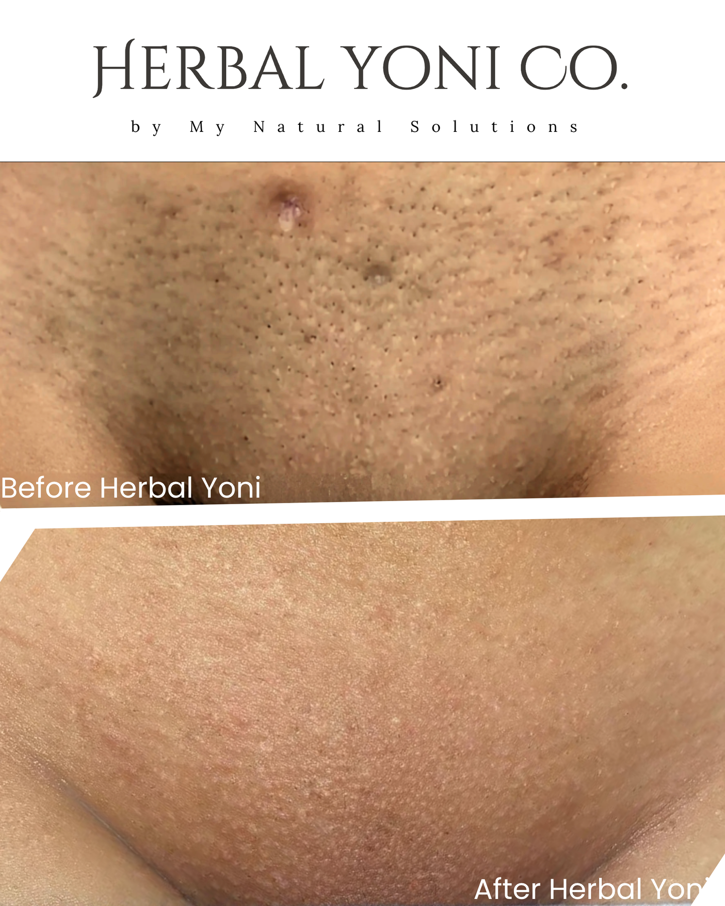 ★ Herbal Yoni Oil
